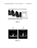 SYSTEM AND METHOD FOR AUTOMATIC MAGNETIC RESONANCE VOLUME COMPOSITION AND     NORMALIZATION diagram and image