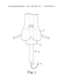 IMAGE-GUIDED HEART VALVE PLACEMENT OR REPAIR diagram and image