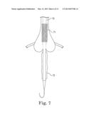 IMAGE-GUIDED HEART VALVE PLACEMENT OR REPAIR diagram and image