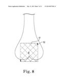 IMAGE-GUIDED HEART VALVE PLACEMENT OR REPAIR diagram and image