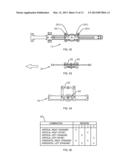 Breast Biopsy Lateral Arm System diagram and image