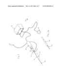 ULTRASOUND CATHETER FOR DISRUPTING BLOOD VESSEL OBSTRUCTIONS diagram and image