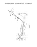 ENHANCED ULTRASOUND VISUALIZATION OF INTRAVASCULAR DEVICES diagram and image