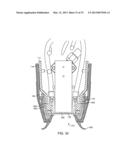 Applicator and Tissue Interface Module for Dermatological Device diagram and image