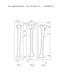 METHOD FOR TIBIAL NAIL INSERTION diagram and image