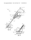 CLUTCH RELEASE MECHANISM FOR VASCULAR CLOSURE DEVICE diagram and image