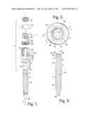 Connecting member with tensioned cord, low profile rigid sleeve and spacer     with torsion control diagram and image