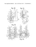 Connecting member with tensioned cord, low profile rigid sleeve and spacer     with torsion control diagram and image