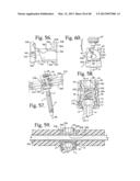 Connecting member with tensioned cord, low profile rigid sleeve and spacer     with torsion control diagram and image