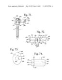 Connecting member with tensioned cord, low profile rigid sleeve and spacer     with torsion control diagram and image