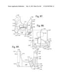 Connecting member with tensioned cord, low profile rigid sleeve and spacer     with torsion control diagram and image