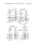 Connecting member with tensioned cord, low profile rigid sleeve and spacer     with torsion control diagram and image