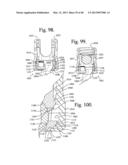 Connecting member with tensioned cord, low profile rigid sleeve and spacer     with torsion control diagram and image