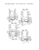 Connecting member with tensioned cord, low profile rigid sleeve and spacer     with torsion control diagram and image