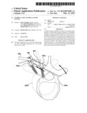 TETHER CLAMP AND IMPLANTATION SYSTEM diagram and image