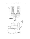 TETHER CLAMP AND IMPLANTATION SYSTEM diagram and image