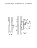 TETHER CLAMP AND IMPLANTATION SYSTEM diagram and image