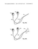 TETHER CLAMP AND IMPLANTATION SYSTEM diagram and image