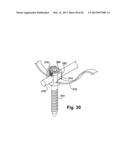 TETHER CLAMP AND IMPLANTATION SYSTEM diagram and image