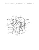 SYSTEMS AND METHODS FOR POSTERIOR DYNAMIC STABILIZATION OF THE SPINE diagram and image