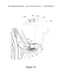 Systems and Methods for Determining a Sleep Disorder Based on Positioning     of the Tongue diagram and image