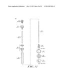 Cardiac Valve Procedure Methods and Devices diagram and image