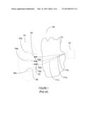 Control of Security Application in a LAN from Outside the LAN diagram and image