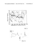 INTELLIGENT TOOTHBRUSH MONTIORING DEVICE diagram and image