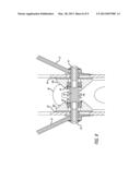 SKATE BRAKING SYSTEM diagram and image