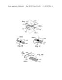 Method and Apparatus for Sterilization of Medical Instruments and Devices     by Ultraviolet Sterilization diagram and image