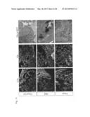 GENETICALLY MODIFIED PARAMYXOVIRUS FOR TREATMENT OF TUMOR DISEASES diagram and image