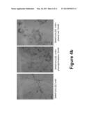 COMPOSITIONS AND METHODS USING SAME FOR TREATING AMYLOID-ASSOCIATED     DISEASES diagram and image