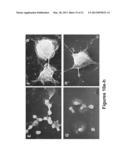 COMPOSITIONS AND METHODS USING SAME FOR TREATING AMYLOID-ASSOCIATED     DISEASES diagram and image