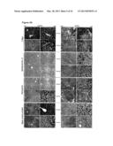 SERUM AND TISSUE BIOMARKERS OF HUMAN HCC diagram and image