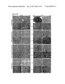 SERUM AND TISSUE BIOMARKERS OF HUMAN HCC diagram and image