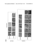 SERUM AND TISSUE BIOMARKERS OF HUMAN HCC diagram and image