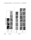 SERUM AND TISSUE BIOMARKERS OF HUMAN HCC diagram and image