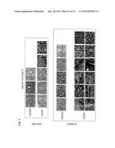 SERUM AND TISSUE BIOMARKERS OF HUMAN HCC diagram and image