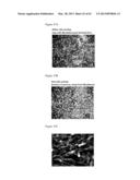 ARTIFICIAL IMMUNE SYSTEM: METHODS OF USE diagram and image