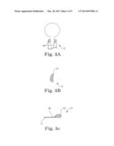 Expandable Implant System diagram and image