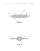 Expandable Implant System diagram and image