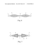 Expandable Implant System diagram and image