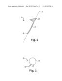 INCONTINENCE TREATMENT DEVICE CONFIGURED FOR URETHRAL PLACEMENT INTO THE     BLADDER diagram and image