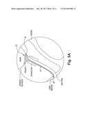 INCONTINENCE TREATMENT DEVICE CONFIGURED FOR URETHRAL PLACEMENT INTO THE     BLADDER diagram and image