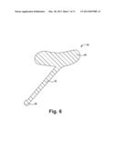 INCONTINENCE TREATMENT DEVICE CONFIGURED FOR URETHRAL PLACEMENT INTO THE     BLADDER diagram and image