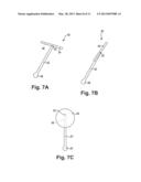 INCONTINENCE TREATMENT DEVICE CONFIGURED FOR URETHRAL PLACEMENT INTO THE     BLADDER diagram and image