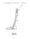 INCONTINENCE TREATMENT DEVICE CONFIGURED FOR URETHRAL PLACEMENT INTO THE     BLADDER diagram and image