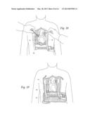 MULTIPURPOSE SURGICAL SPONGEPADS, DEVICES, SYSTEMS, AND METHODS diagram and image