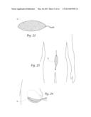 MULTIPURPOSE SURGICAL SPONGEPADS, DEVICES, SYSTEMS, AND METHODS diagram and image