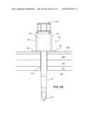 Endoscopic Ports and Related Kits and Methods diagram and image